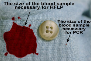 Image of RFLP and PCR blood sizes