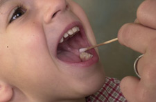Image of young boy getting a referenec sample taken from his mouth.